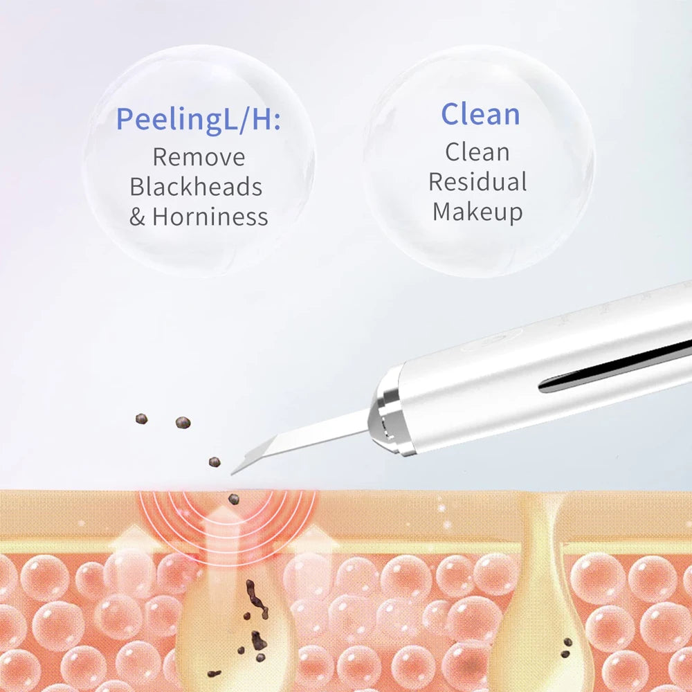 Electric Blackhead Remover