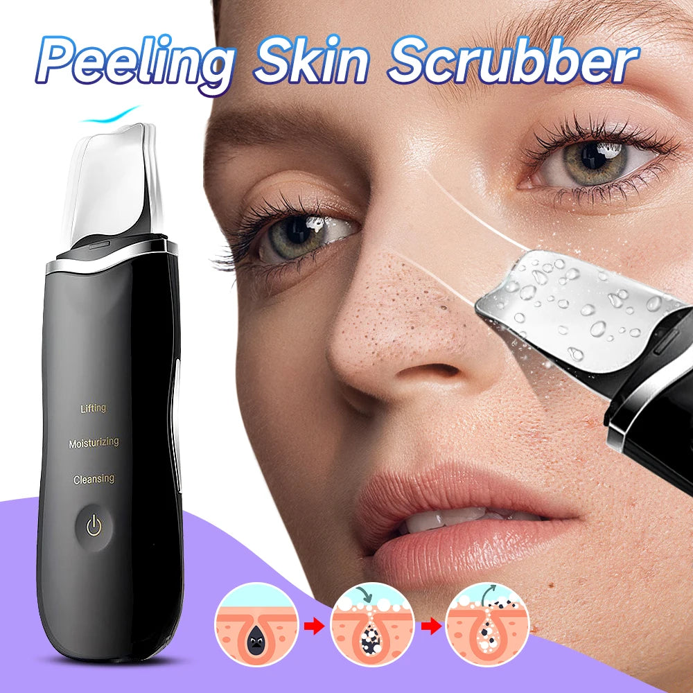 Electric Blackhead Remover
